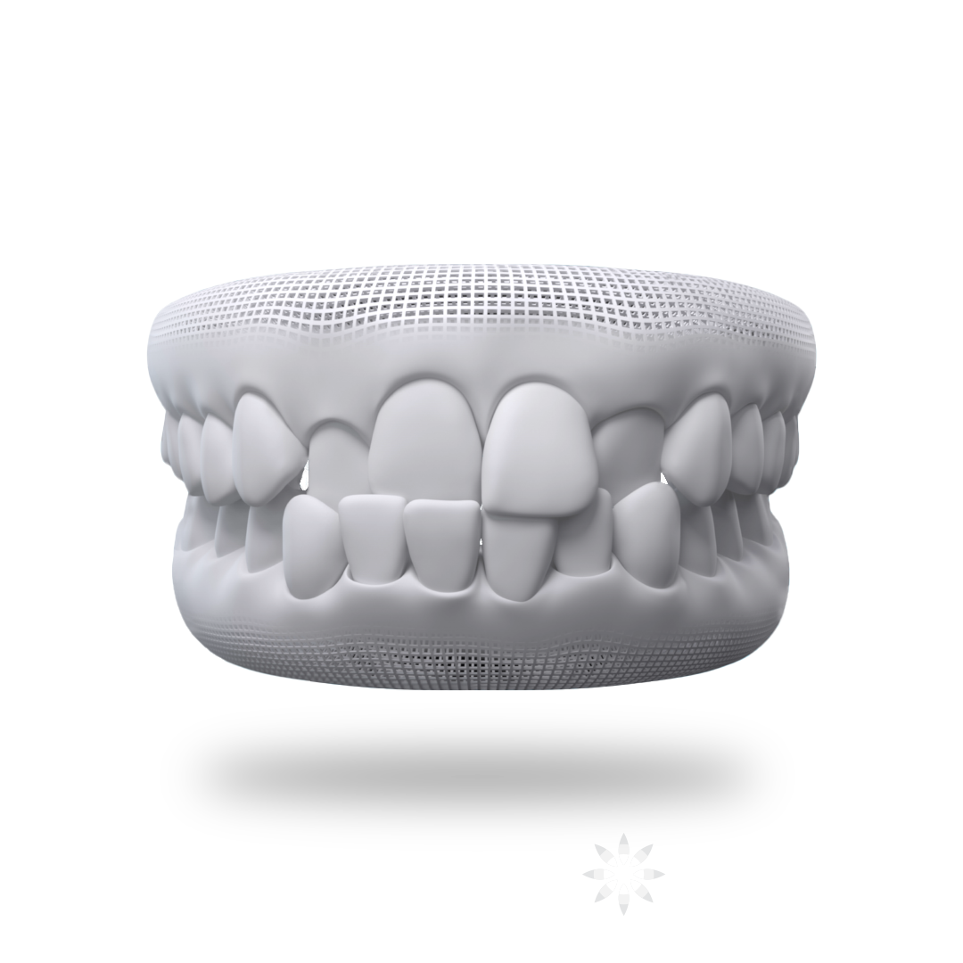 Crossbite Teeth