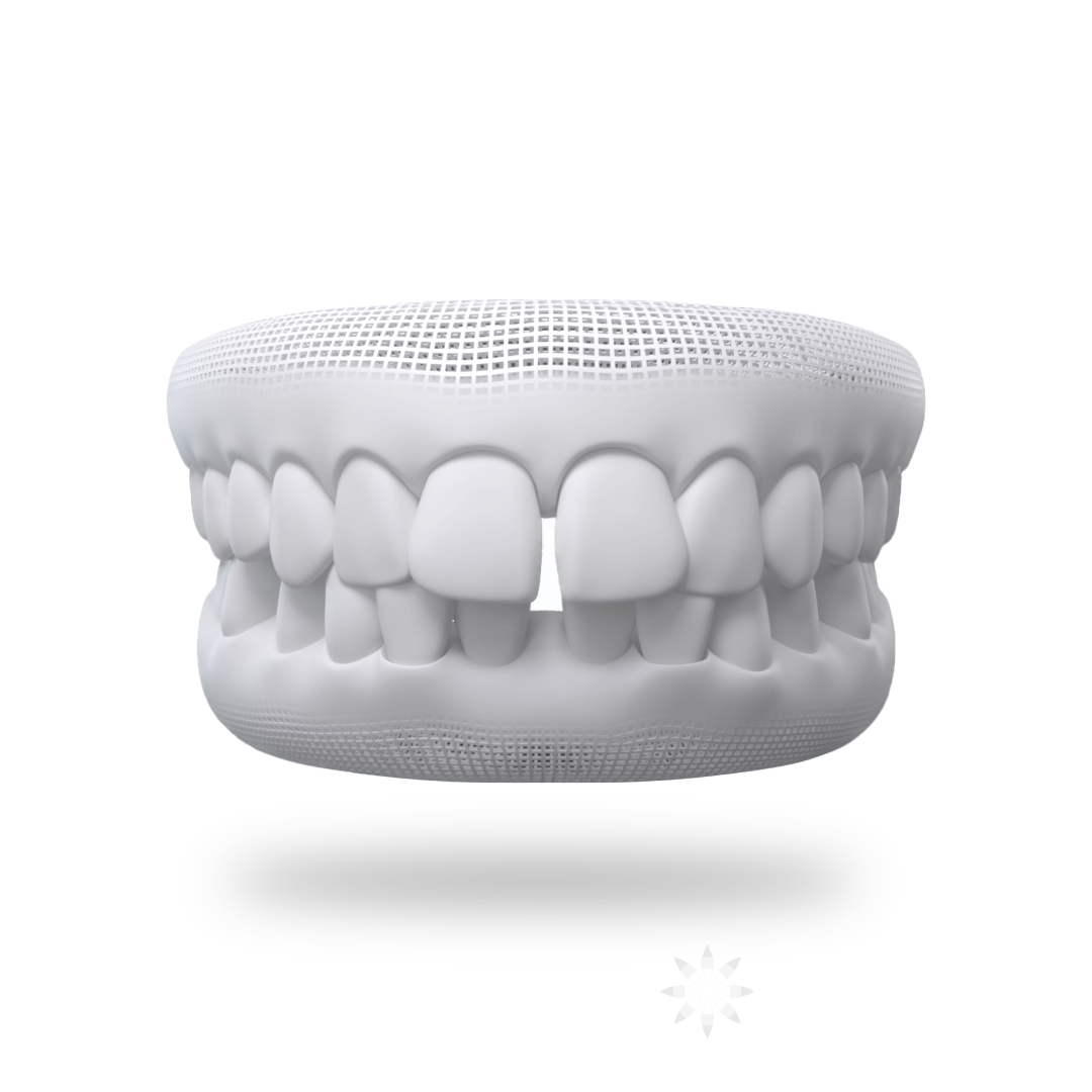 Gapped Teeth