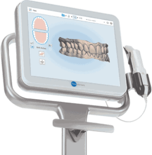 invisalign-works-img1